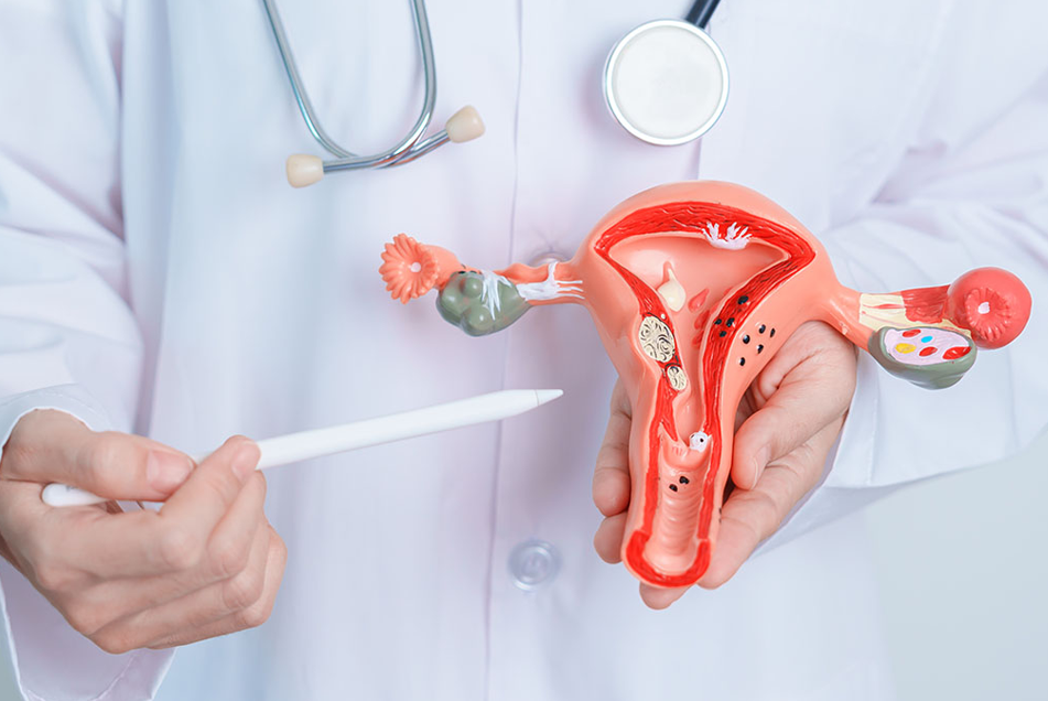 Endometriosis Diagnosis & Treatment