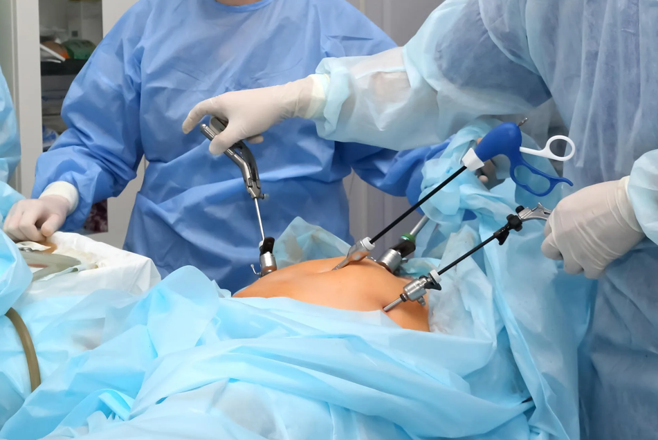 Laparoscopy Procedures – Diagnosis, Treatment & Recovery